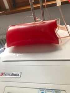 plasma