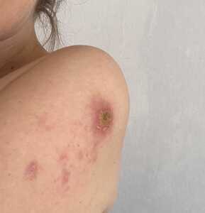 IMG 8170 2 IMG 8170 2